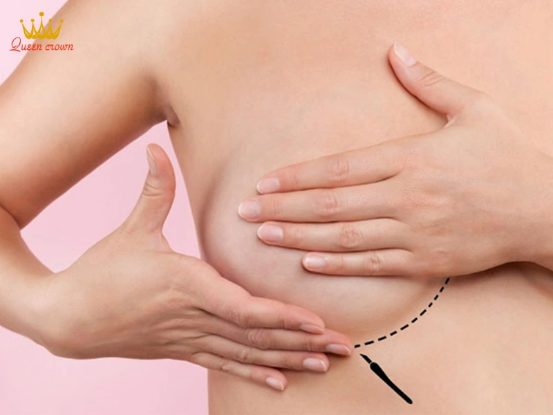 Tìm hiểu về cách massage tăng vòng 1