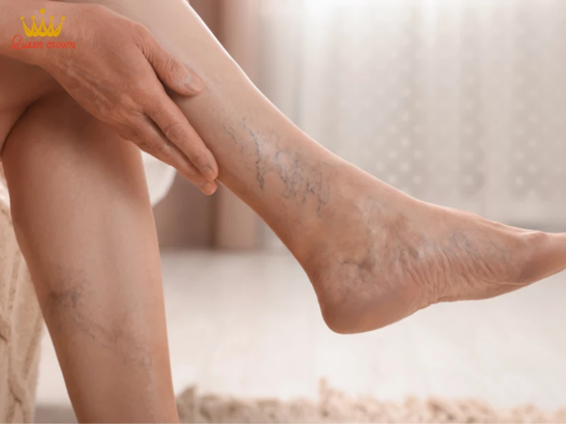 Lợi ích của massage chân dành cho người bị suy giảm tĩnh mạch