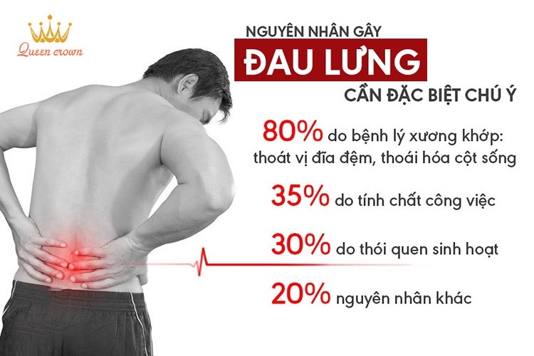 Nguyên nhân gây đau lưng