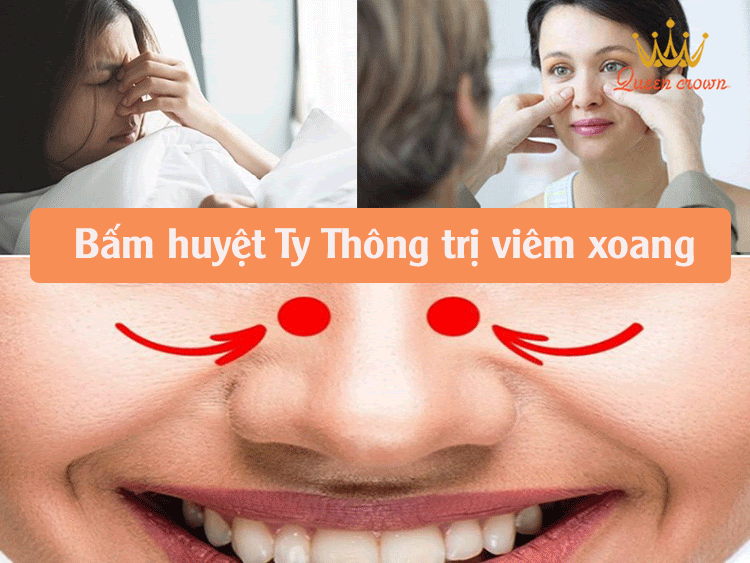 Bấm huyệt Ty Thông trị viêm xoang
