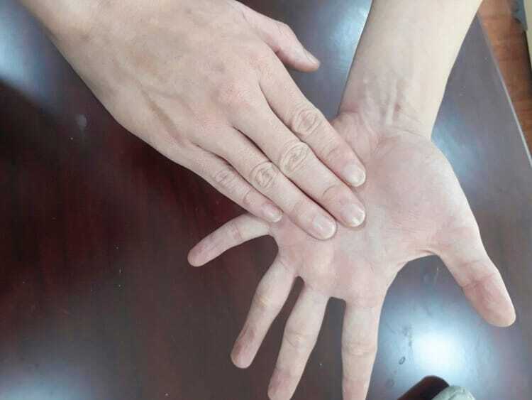 Cách massage tay
